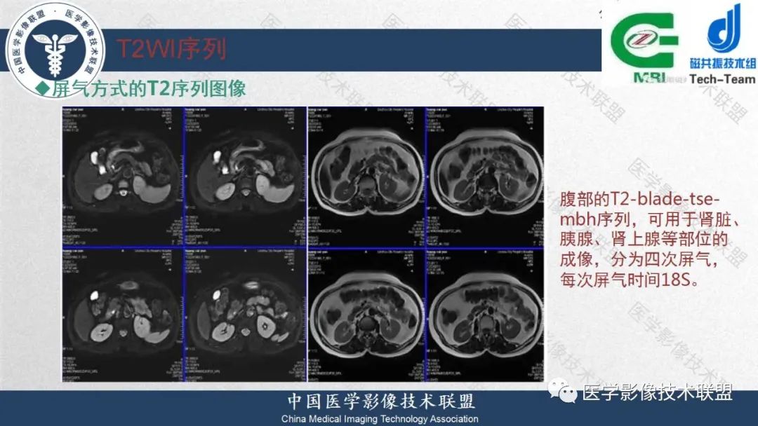 影像PPT - 【PPT】肝脏磁共振规范化扫描特异性对比剂增强MR—扫描方案与经验分享-22