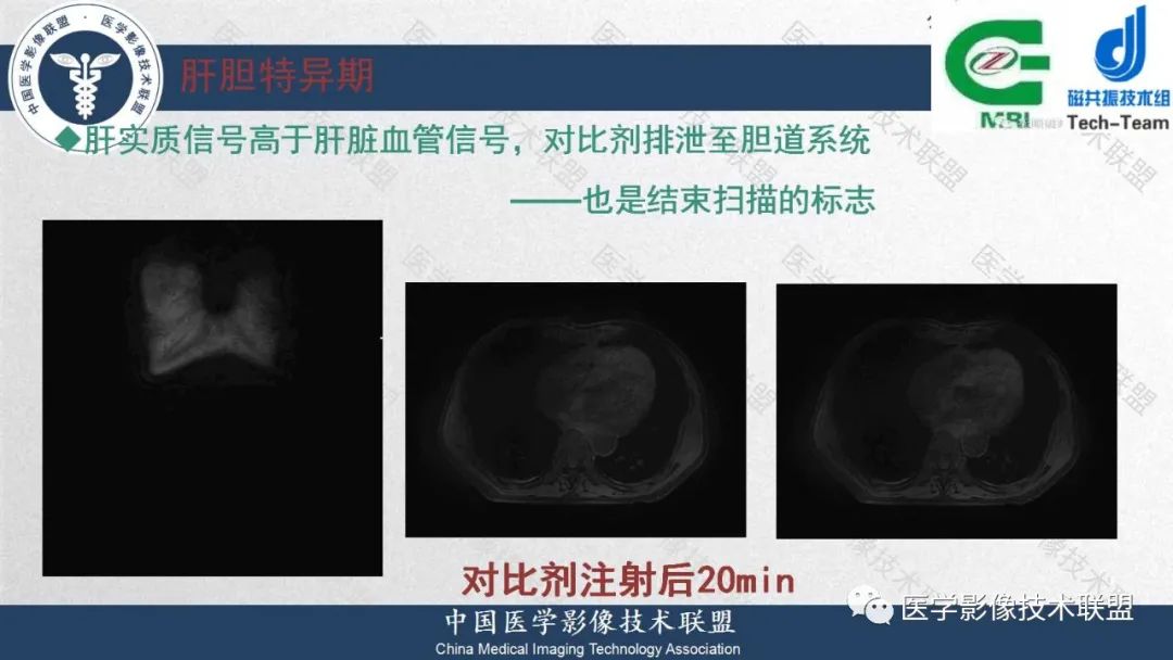 影像PPT - 【PPT】肝脏磁共振规范化扫描特异性对比剂增强MR—扫描方案与经验分享-23