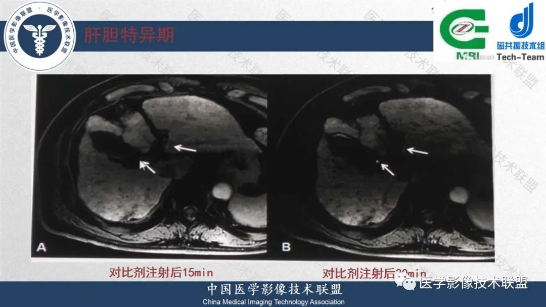 影像PPT - 【PPT】肝脏磁共振规范化扫描特异性对比剂增强MR—扫描方案与经验分享-25