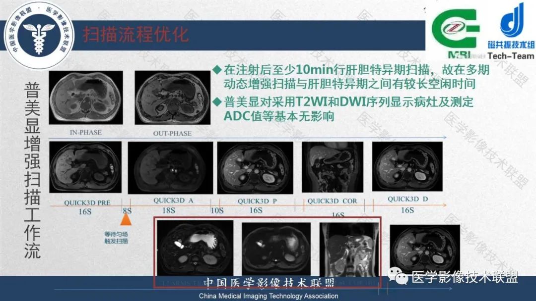影像PPT - 【PPT】肝脏磁共振规范化扫描特异性对比剂增强MR—扫描方案与经验分享-27