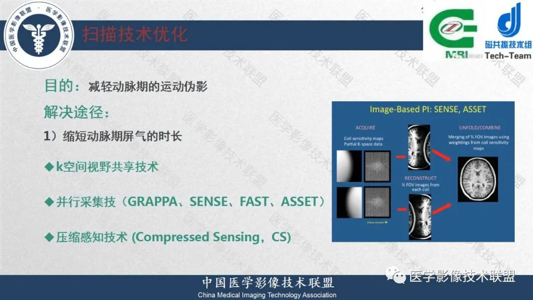 影像PPT - 【PPT】肝脏磁共振规范化扫描特异性对比剂增强MR—扫描方案与经验分享-29