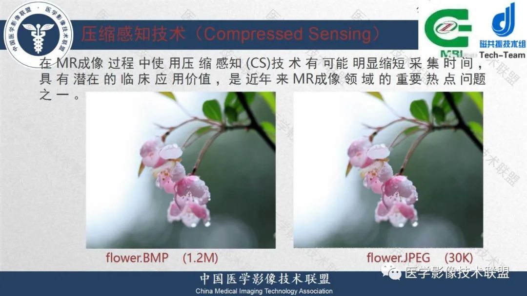 影像PPT - 【PPT】肝脏磁共振规范化扫描特异性对比剂增强MR—扫描方案与经验分享-30