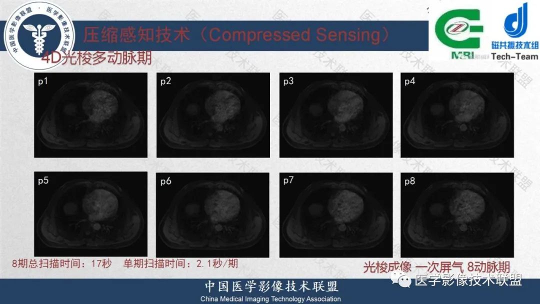 影像PPT - 【PPT】肝脏磁共振规范化扫描特异性对比剂增强MR—扫描方案与经验分享-31