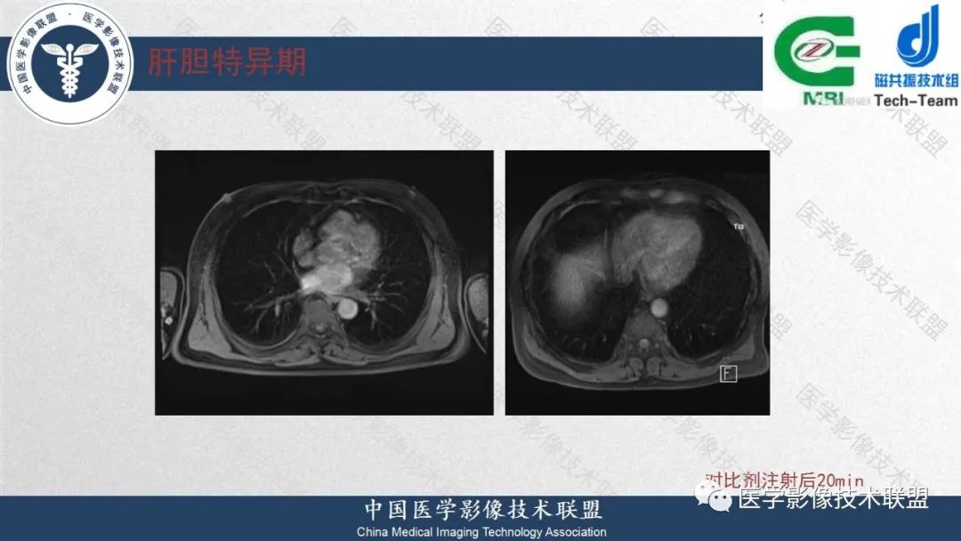 影像PPT - 【PPT】肝脏磁共振规范化扫描特异性对比剂增强MR—扫描方案与经验分享-36