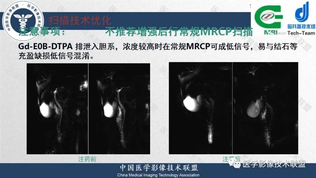 影像PPT - 【PPT】肝脏磁共振规范化扫描特异性对比剂增强MR—扫描方案与经验分享-38