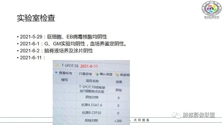 影像PPT - 【病例】出乎意料的“隐球君”,你想到了吗?-8 影像PPT - 【病例】出乎意料的“隐球君”,你想到了吗?-8