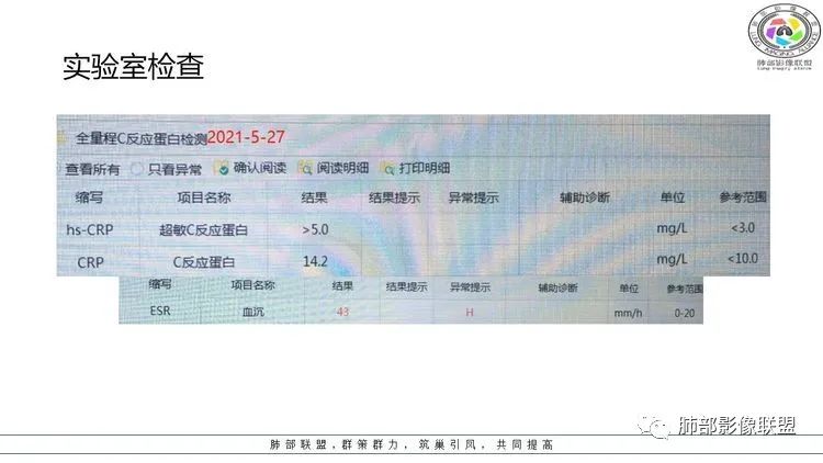 影像PPT - 【病例】出乎意料的“隐球君”,你想到了吗?-6 影像PPT - 【病例】出乎意料的“隐球君”,你想到了吗?-6