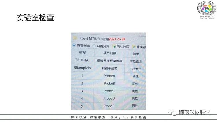 影像PPT - 【病例】出乎意料的“隐球君”,你想到了吗?-7 影像PPT - 【病例】出乎意料的“隐球君”,你想到了吗?-7