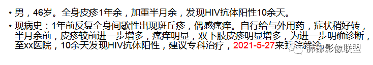 影像PPT - 【病例】出乎意料的“隐球君”,你想到了吗?-70 影像PPT - 【病例】出乎意料的“隐球君”,你想到了吗?-70