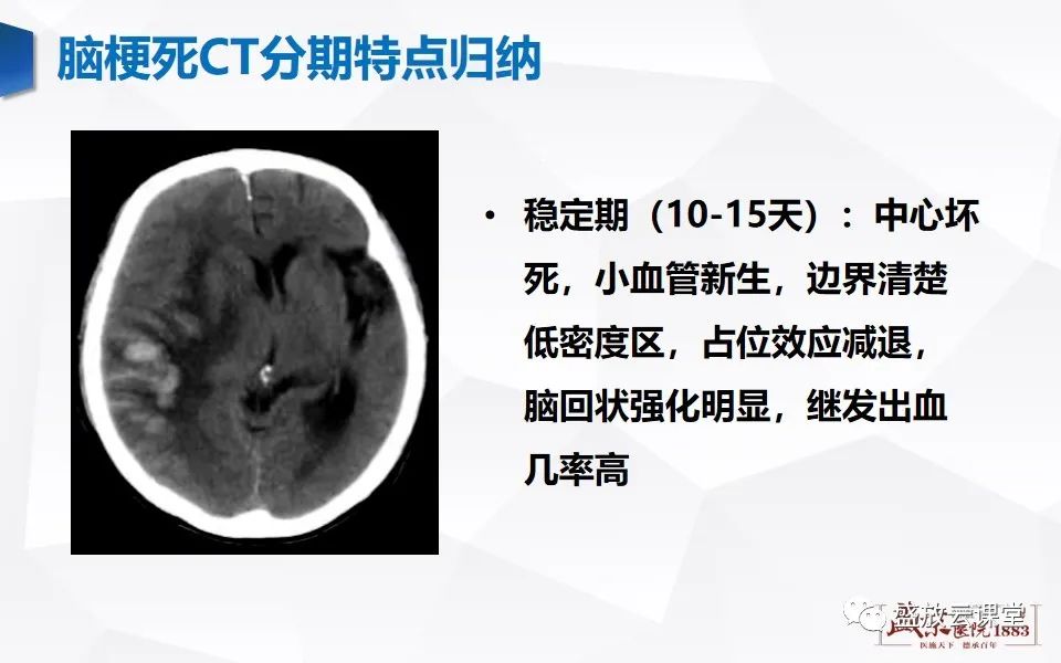影像PPT - 【PPT】脑血管病（脑梗死及各期演变）-19