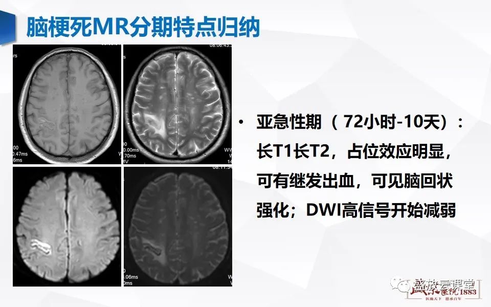 影像PPT - 【PPT】脑血管病（脑梗死及各期演变）-22