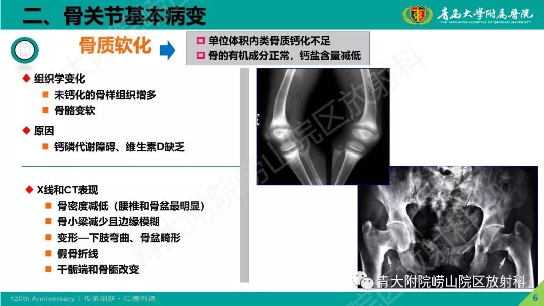 影像PPT - 【PPT】骨关节影像诊断培训要点解析-6