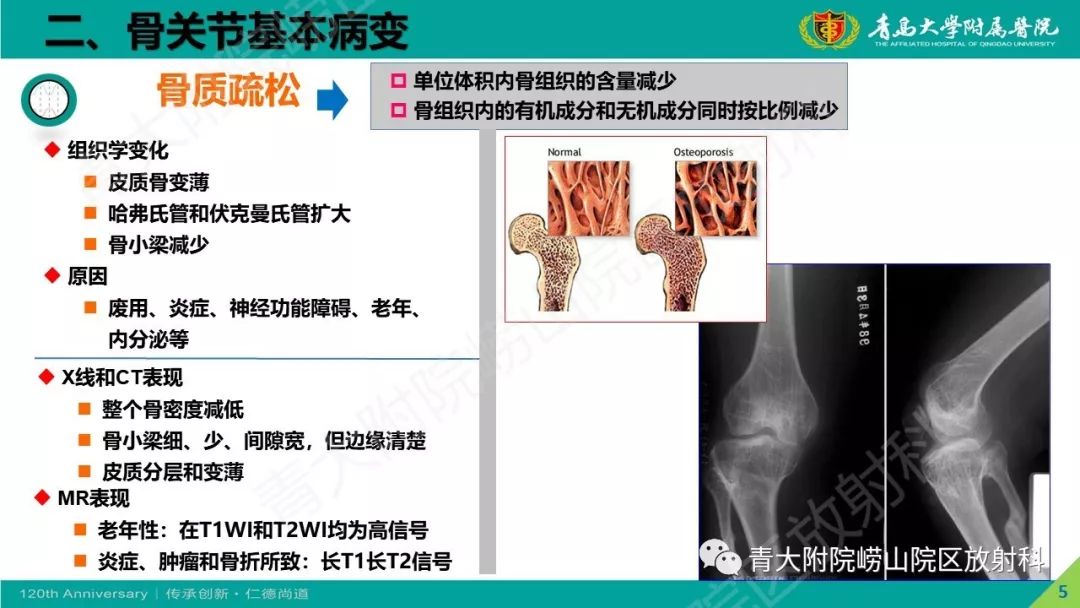 影像PPT - 【PPT】骨关节影像诊断培训要点解析-5