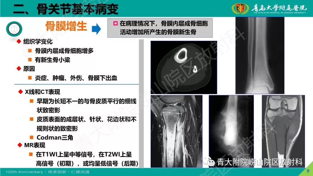 影像PPT - 【PPT】骨关节影像诊断培训要点解析-9