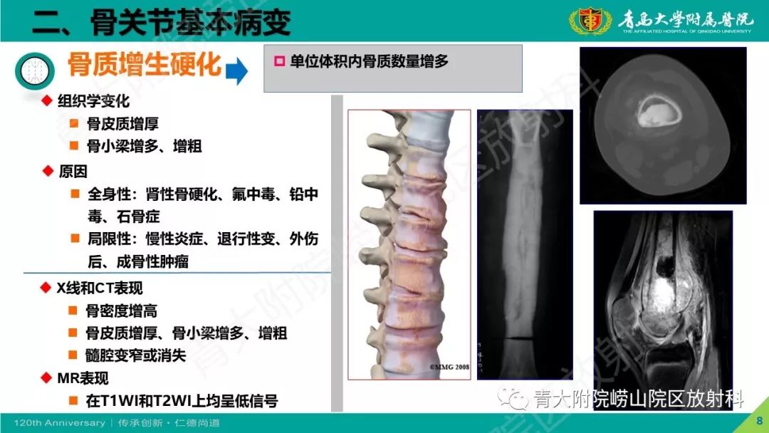 影像PPT - 【PPT】骨关节影像诊断培训要点解析-8