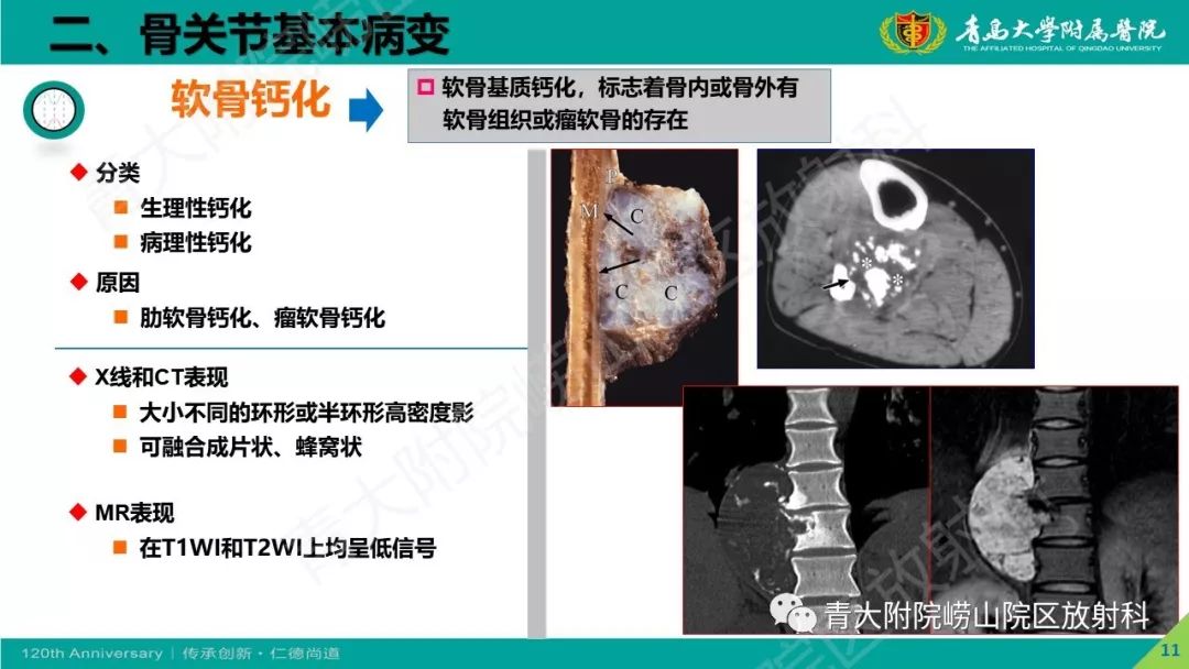 影像PPT - 【PPT】骨关节影像诊断培训要点解析-11