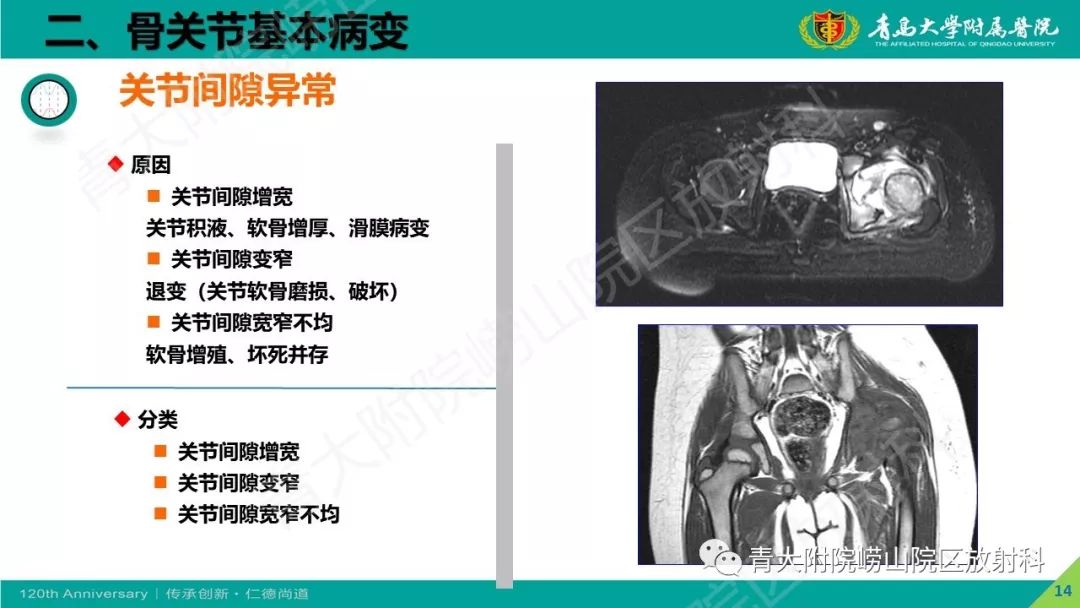 影像PPT - 【PPT】骨关节影像诊断培训要点解析-14