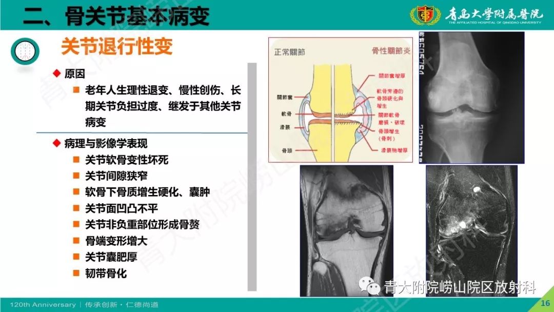 影像PPT - 【PPT】骨关节影像诊断培训要点解析-16