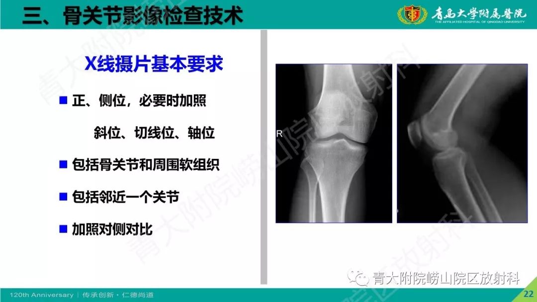 影像PPT - 【PPT】骨关节影像诊断培训要点解析-22