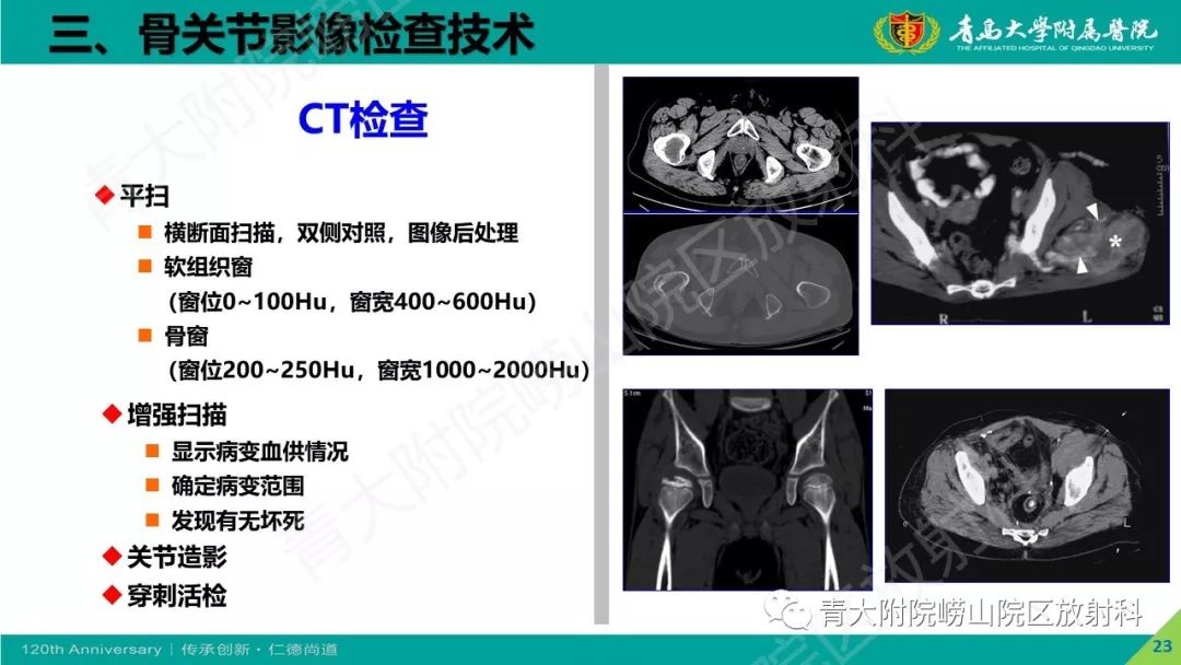 影像PPT - 【PPT】骨关节影像诊断培训要点解析-23
