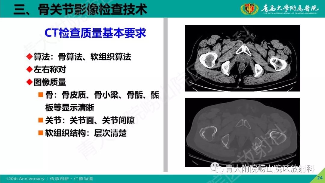 影像PPT - 【PPT】骨关节影像诊断培训要点解析-24