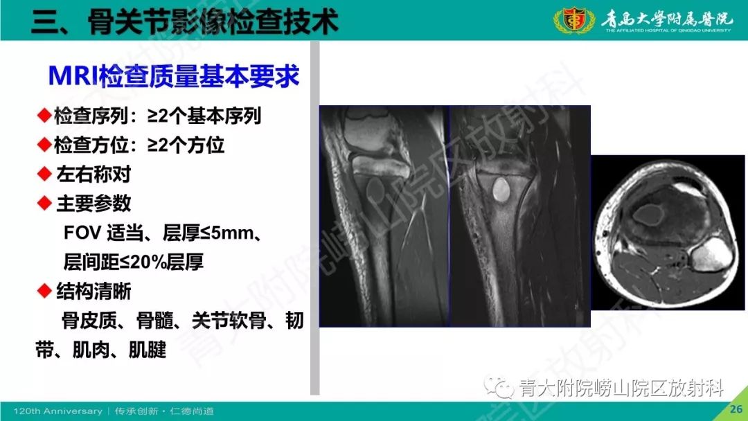 影像PPT - 【PPT】骨关节影像诊断培训要点解析-26