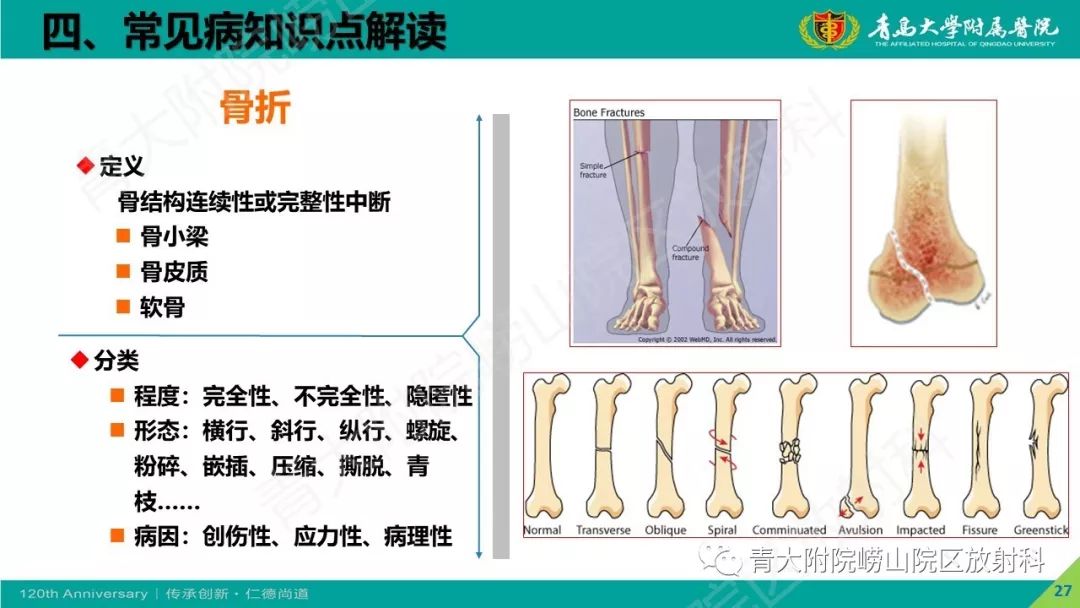 影像PPT - 【PPT】骨关节影像诊断培训要点解析-27