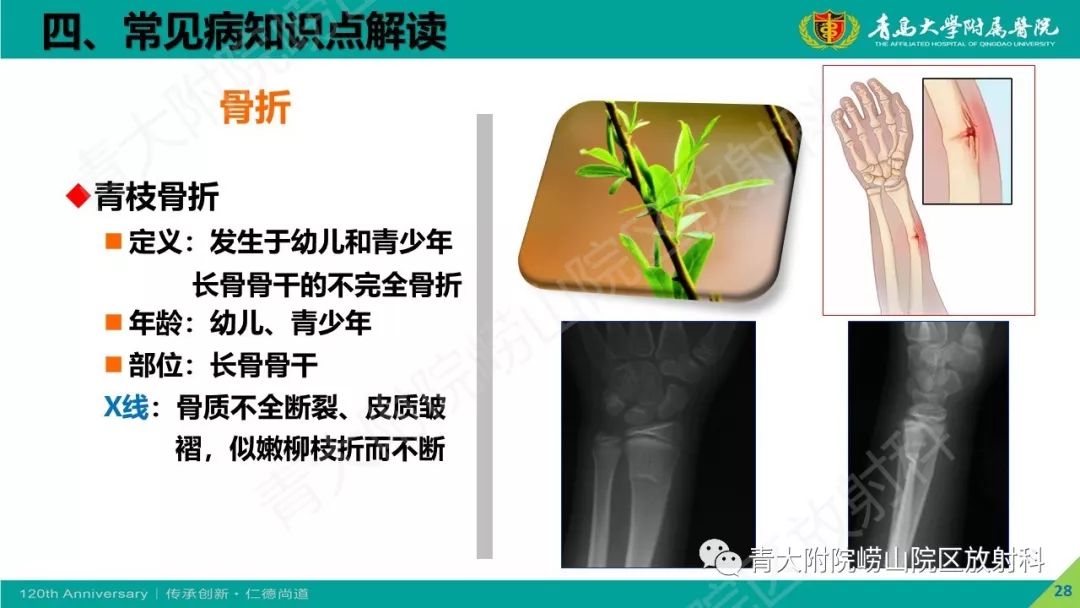 影像PPT - 【PPT】骨关节影像诊断培训要点解析-28