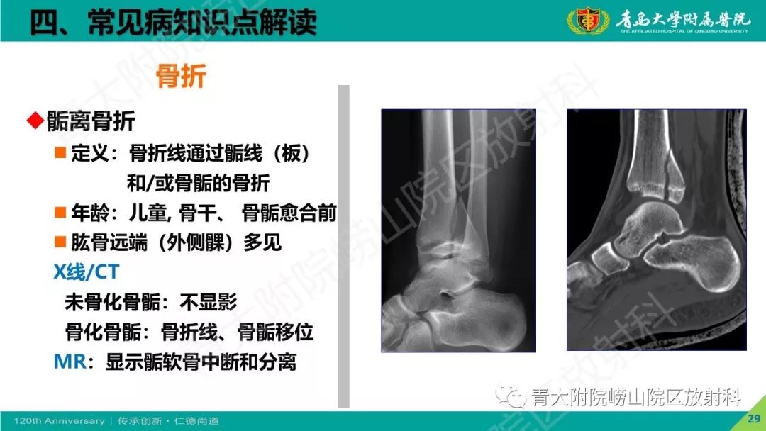 影像PPT - 【PPT】骨关节影像诊断培训要点解析-29