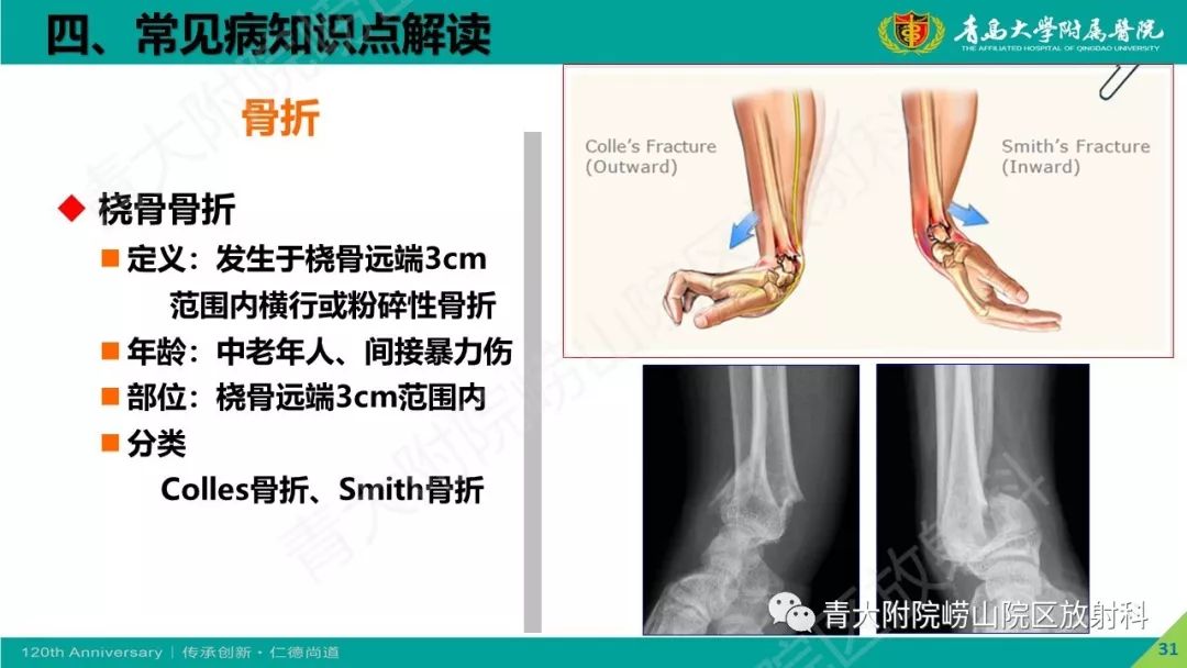 影像PPT - 【PPT】骨关节影像诊断培训要点解析-31