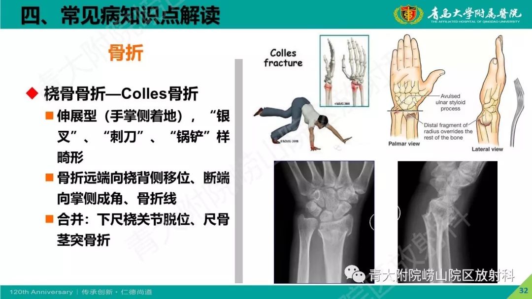 影像PPT - 【PPT】骨关节影像诊断培训要点解析-32