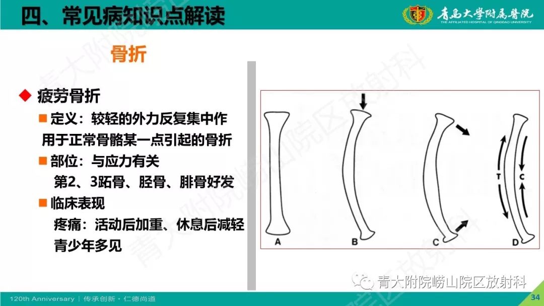 影像PPT - 【PPT】骨关节影像诊断培训要点解析-34