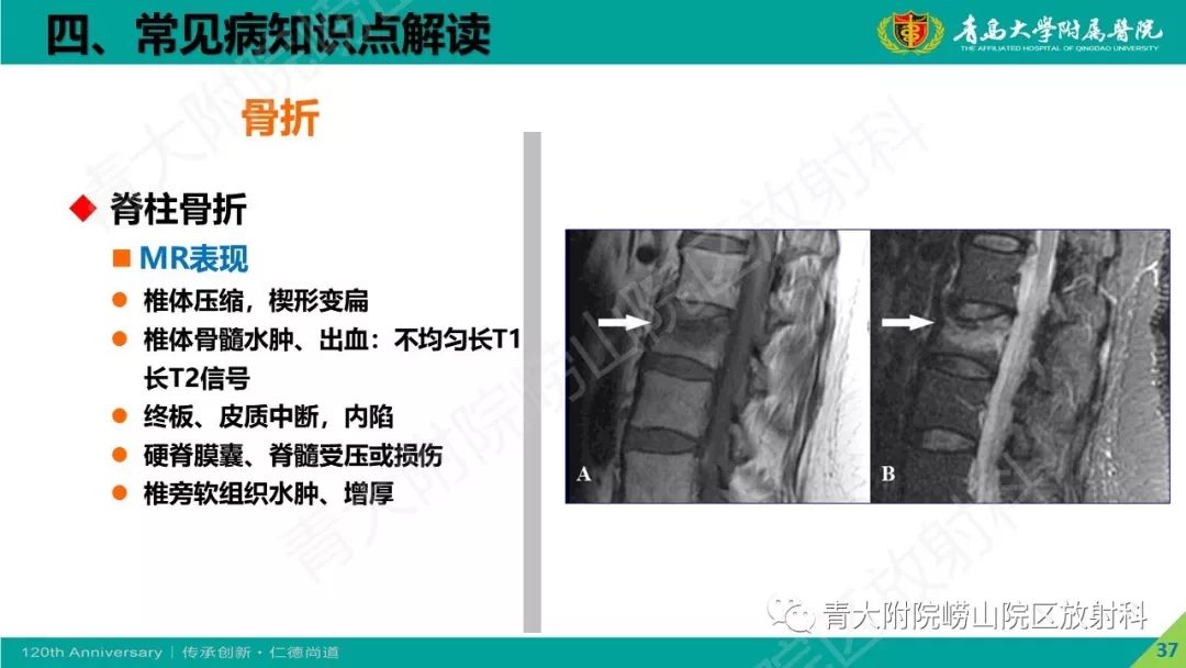 影像PPT - 【PPT】骨关节影像诊断培训要点解析-37