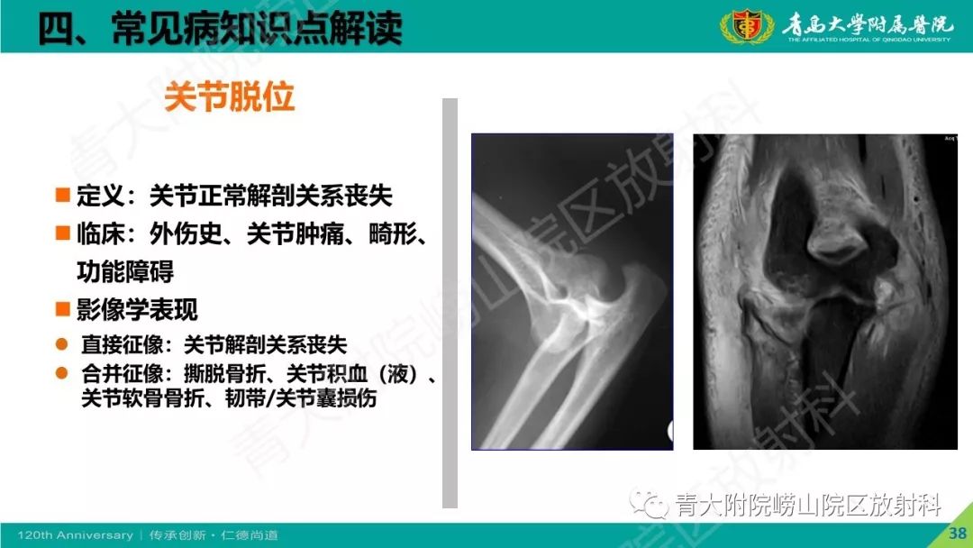 影像PPT - 【PPT】骨关节影像诊断培训要点解析-38