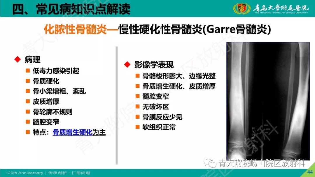 影像PPT - 【PPT】骨关节影像诊断培训要点解析-44