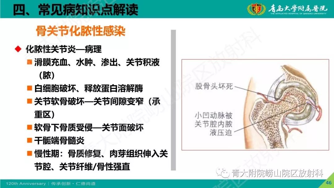 影像PPT - 【PPT】骨关节影像诊断培训要点解析-46