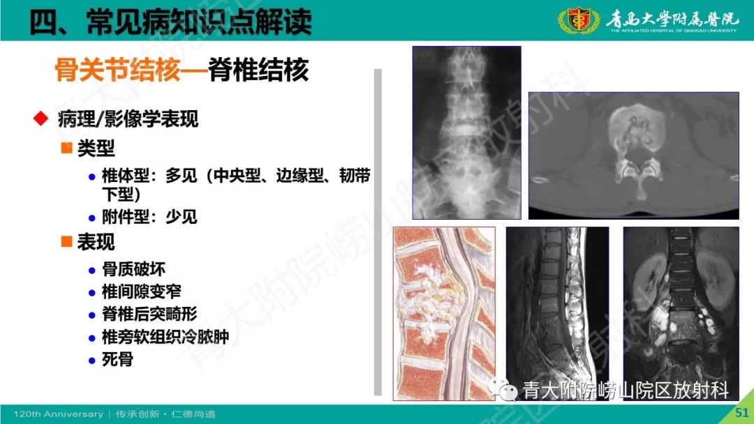 影像PPT - 【PPT】骨关节影像诊断培训要点解析-51
