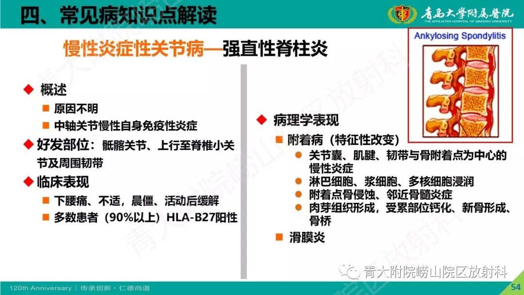 影像PPT - 【PPT】骨关节影像诊断培训要点解析-54