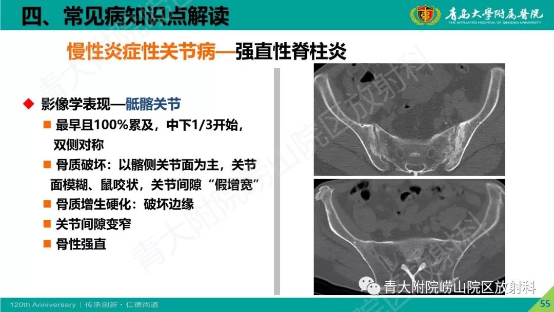 影像PPT - 【PPT】骨关节影像诊断培训要点解析-55