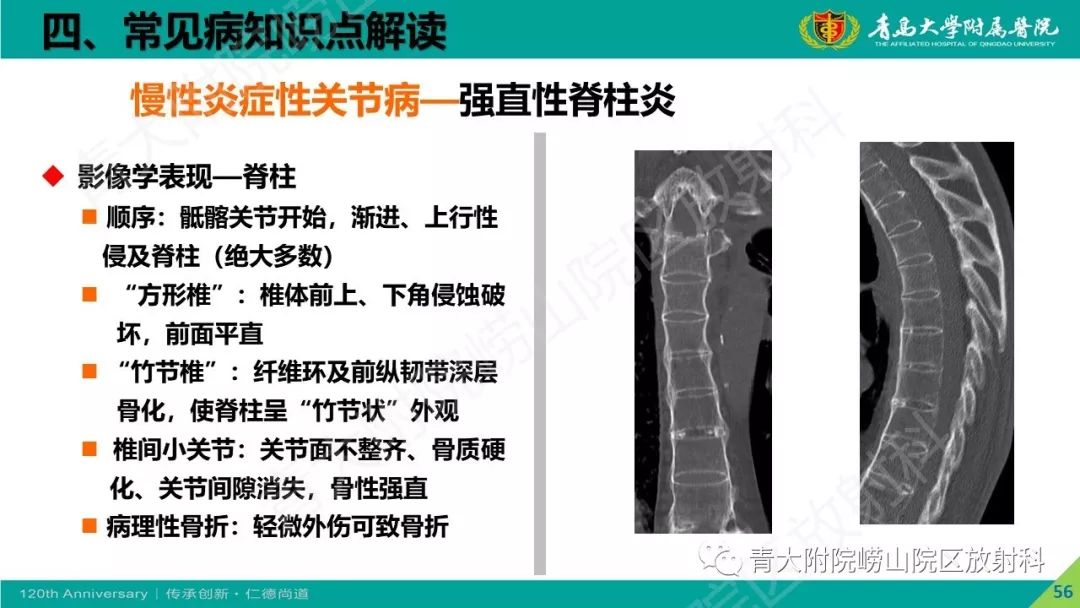 影像PPT - 【PPT】骨关节影像诊断培训要点解析-56