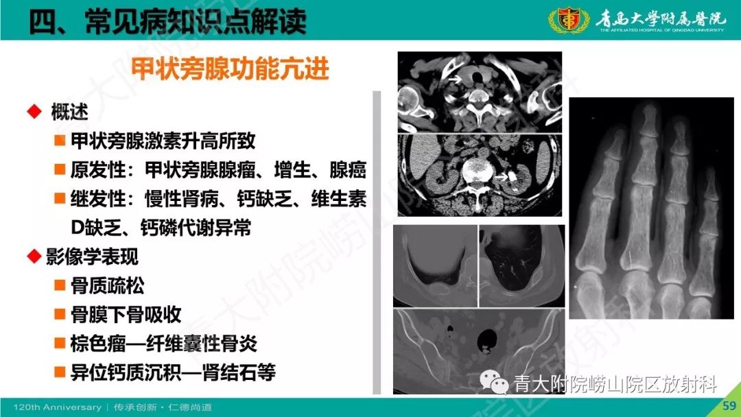影像PPT - 【PPT】骨关节影像诊断培训要点解析-59
