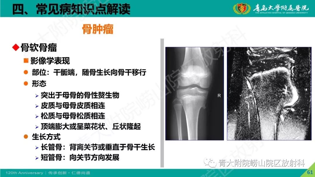 影像PPT - 【PPT】骨关节影像诊断培训要点解析-61