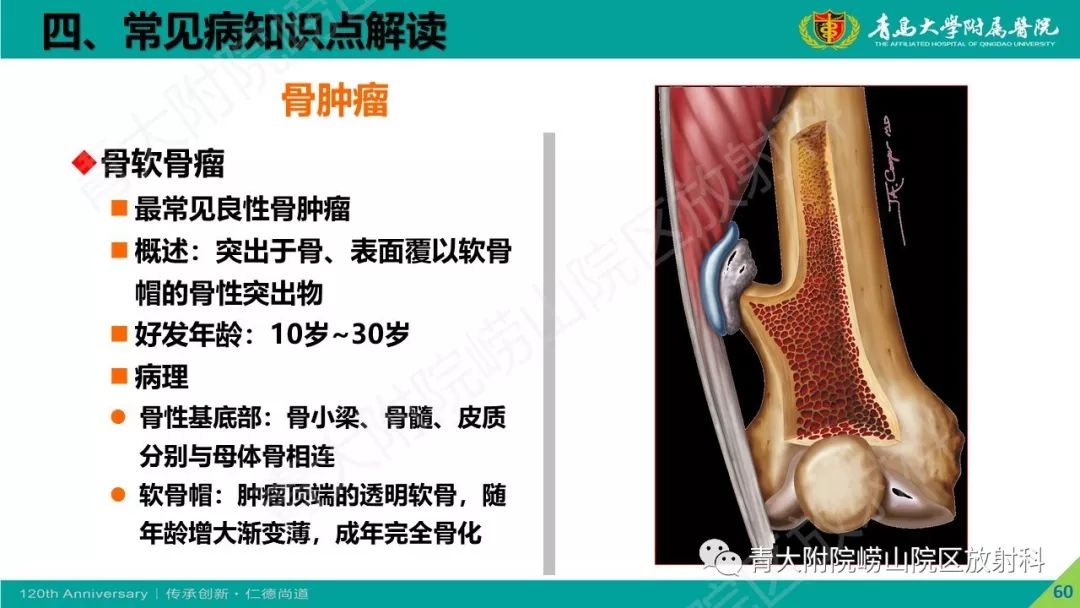 影像PPT - 【PPT】骨关节影像诊断培训要点解析-60