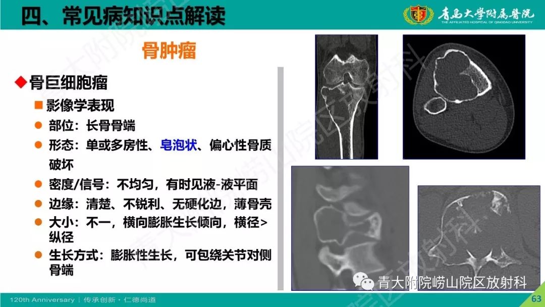 影像PPT - 【PPT】骨关节影像诊断培训要点解析-63