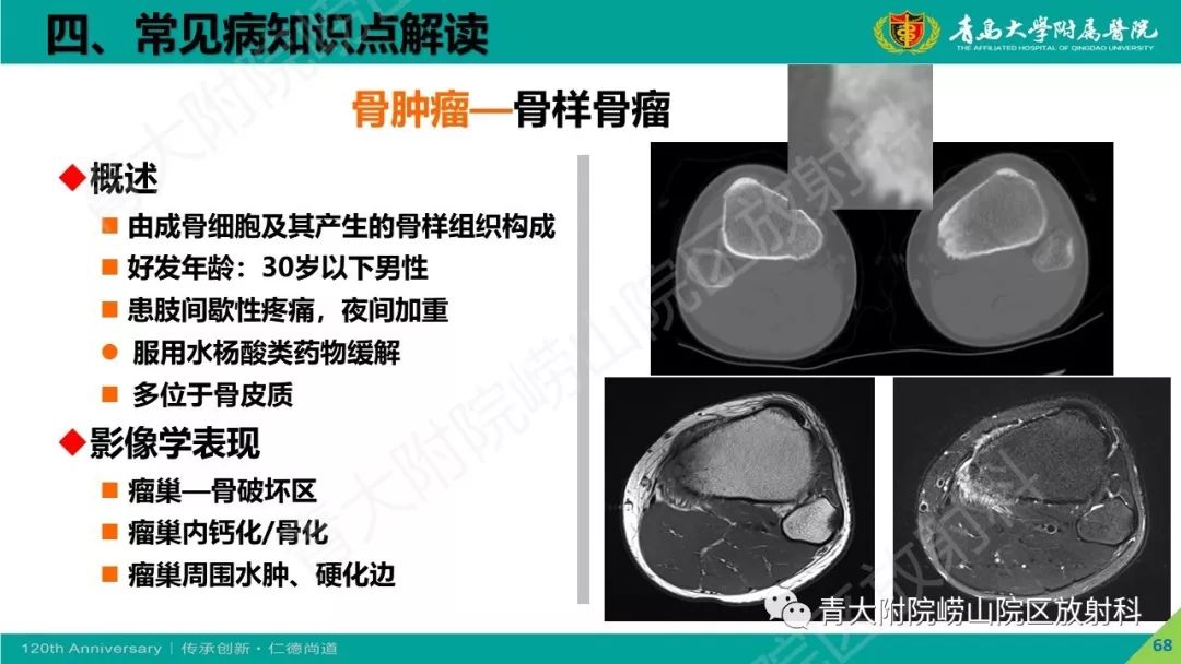 影像PPT - 【PPT】骨关节影像诊断培训要点解析-68