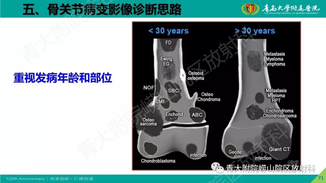影像PPT - 【PPT】骨关节影像诊断培训要点解析-71