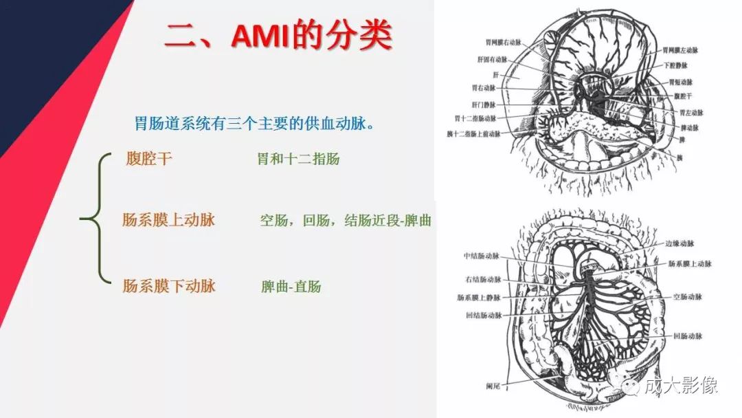 影像PPT - 【PPT】多层螺旋CT诊断急性肠系膜缺血-6