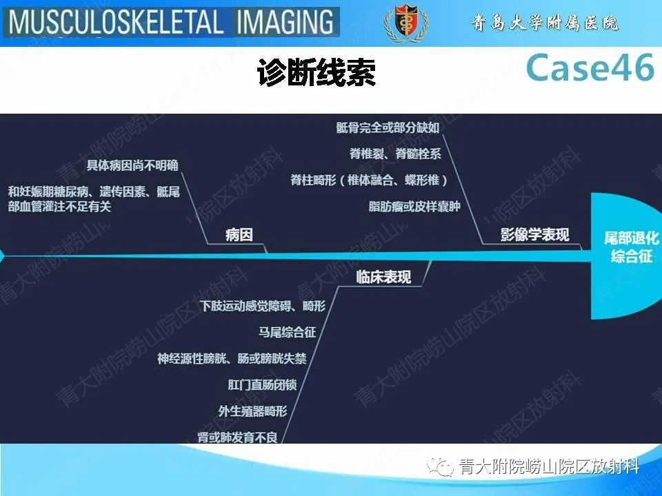 影像PPT - 【PPT】尾部退化综合征-22