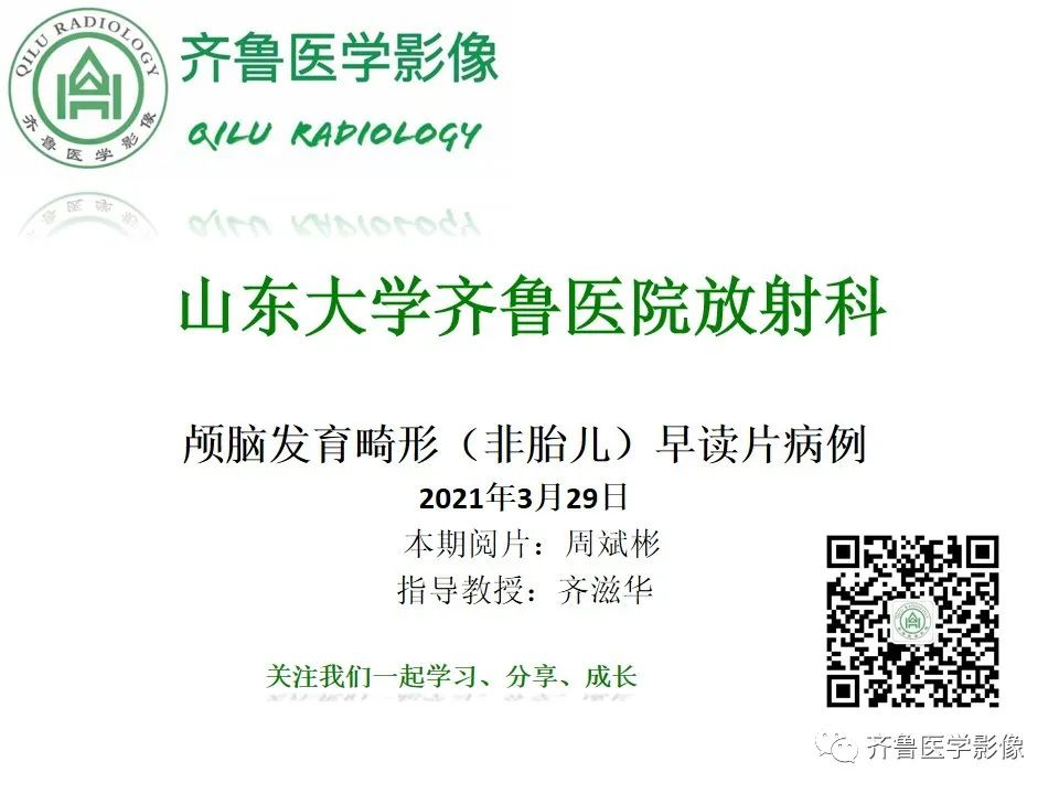 影像PPT - 【病例】胼胝体发育不良2例影像诊断-1