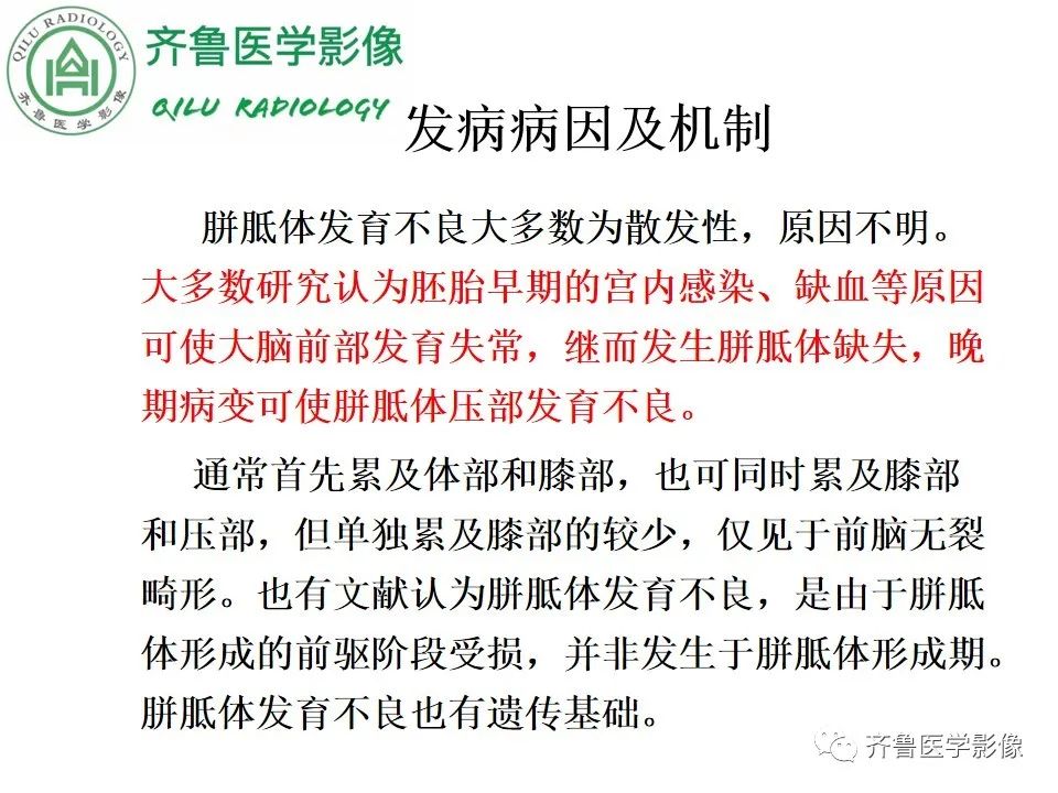 影像PPT - 【病例】胼胝体发育不良2例影像诊断-12